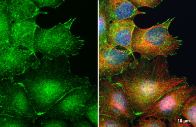 Anti-EDG4 / LPAR2 antibody [HL3661] used in Immunocytochemistry/ Immunofluorescence (ICC/IF). GTX641652