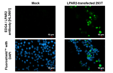Anti-EDG4 / LPAR2 antibody [HL3661] used in Immunocytochemistry/ Immunofluorescence (ICC/IF). GTX641652