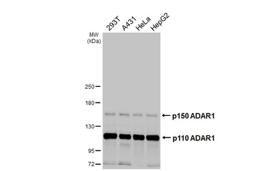 Anti-ADAR1 antibody [HL3666] used in Western Blot (WB). GTX641694