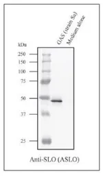 Anti-Streptolysin O antibody used in Western Blot (WB). GTX64171
