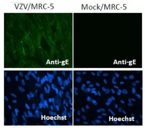 Anti-Varicella Zoster virus gE antibody [#9] used in Immunocytochemistry/ Immunofluorescence (ICC/IF). GTX64187
