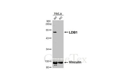 Anti-LDB1 antibody [HL3711] used in Western Blot (WB). GTX641901