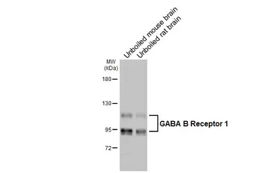 Anti-GABA B Receptor 1 antibody [GT83] used in Western Blot (WB). GTX641938