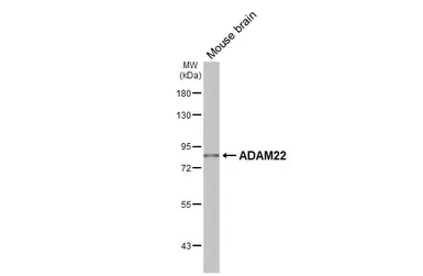 Anti-ADAM22 antibody [GT85] used in Western Blot (WB). GTX641940