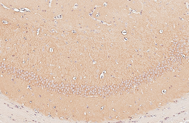 Anti-GIT1 antibody [GT87] used in IHC (Paraffin sections) (IHC-P). GTX641942