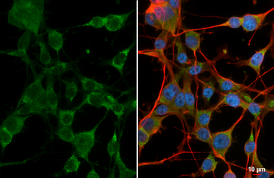Anti-GIT1 antibody [GT87] used in Immunocytochemistry/ Immunofluorescence (ICC/IF). GTX641942