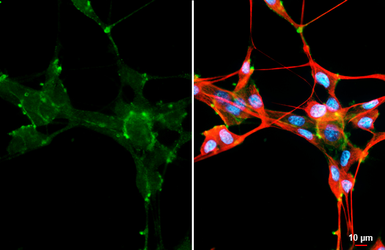 Anti-LRRC15 antibody [HL3750] used in Immunocytochemistry/ Immunofluorescence (ICC/IF). GTX641949