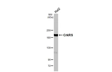 Anti-CDK12 antibody [HL3756] used in Western Blot (WB). GTX641955