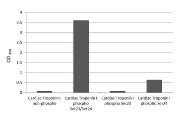 Anti-Cardiac Troponin I (phospho Ser23/Ser24) antibody [HL3796] used in  (). GTX642015