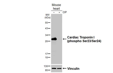 Anti-Cardiac Troponin I (phospho Ser23/Ser24) antibody [HL3796] used in Western Blot (WB). GTX642015