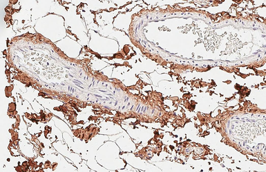 Anti-COL1A1 antibody [GT91] used in IHC (Paraffin sections) (IHC-P). GTX642024