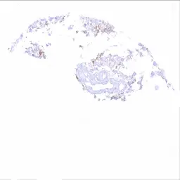 Anti-EGFRvIII antibody [HMV3805] HistoMAX&trade; used in IHC (Paraffin sections) (IHC-P). GTX642029
