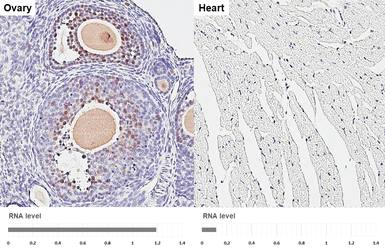 Anti-Rad51 antibody [HL3807] used in IHC (Paraffin sections) (IHC-P). GTX642031
