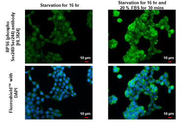 Anti-RPS6 (phospho Ser240/Ser244) antibody [HL3824] used in Immunocytochemistry/ Immunofluorescence (ICC/IF). GTX642048