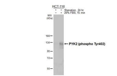 Anti-PYK2 (phospho Tyr402) antibody [HL3860] used in Western Blot (WB). GTX642098
