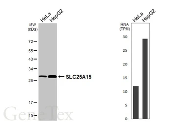 Anti-SLC25A15 antibody [HL3883] used in Western Blot (WB). GTX642124