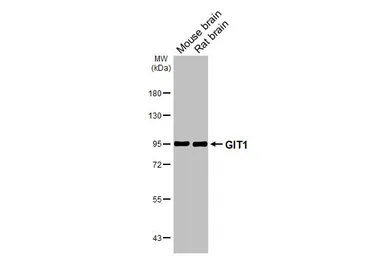Anti-GIT1 antibody [GT104] used in Western Blot (WB). GTX642152