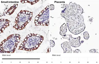 Anti-HKDC1 antibody [HL3961] used in IHC (Paraffin sections) (IHC-P). GTX642211