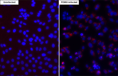 Anti-Powassan virus NS3 antibody [HL3967] used in Immunocytochemistry/ Immunofluorescence (ICC/IF). GTX642217