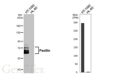 Anti-Paxillin antibody [HL4001] used in Western Blot (WB). GTX642332