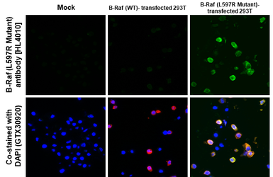 Anti-B-Raf (L597R Mutant) antibody [HL4010] used in IHC-P (cell pellet) (IHC-P (cell pellet)). GTX642341