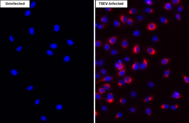 Anti-Tick-borne encephalitis virus (TBEV) Envelope antibody [HL4030] used in Immunocytochemistry/ Immunofluorescence (ICC/IF). GTX642361