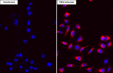 Anti-Tick-borne encephalitis virus (TBEV) Envelope antibody [HL4034] used in Immunocytochemistry/ Immunofluorescence (ICC/IF). GTX642365
