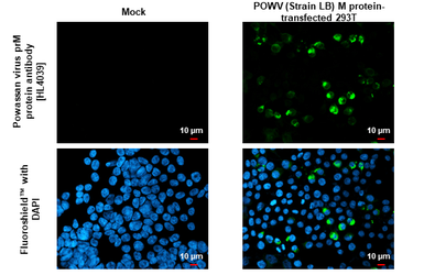Anti-Powassan virus prM protein antibody [HL4039] used in Immunocytochemistry/ Immunofluorescence (ICC/IF). GTX642370