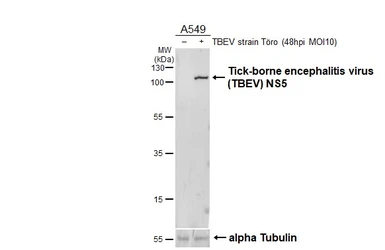 Anti-Tick-borne encephalitis virus (TBEV) NS5 antibody [HL4062] used in Western Blot (WB). GTX642477