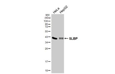 Anti-SLBP antibody [HL4074] used in Western Blot (WB). GTX642513