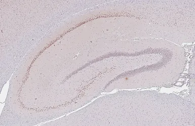Anti-MATH2 antibody [HL4081] used in IHC (Paraffin sections) (IHC-P). GTX642520