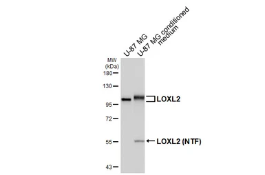 Anti-LOXL2 antibody [HL4109] used in Western Blot (WB). GTX642555