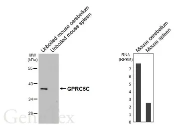 Anti-GPRC5C antibody [HL4114] used in Western Blot (WB). GTX642560