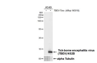 Anti-Tick-borne encephalitis virus (TBEV) NS2B antibody [HL4147] used in Western Blot (WB). GTX642952