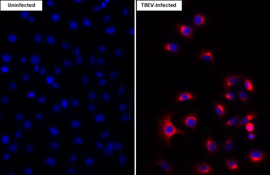 Anti-Tick-borne encephalitis virus (TBEV) NS2B antibody [HL4149] used in Immunocytochemistry/ Immunofluorescence (ICC/IF). GTX642954
