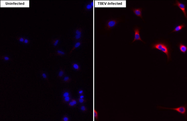 Anti-Tick-borne encephalitis virus (TBEV) NS4A antibody [HL4155] used in Immunocytochemistry/ Immunofluorescence (ICC/IF). GTX642960
