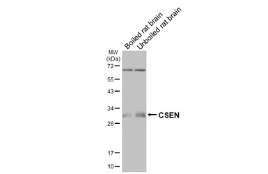 Anti-CSEN antibody [GT177] used in Western Blot (WB). GTX643015