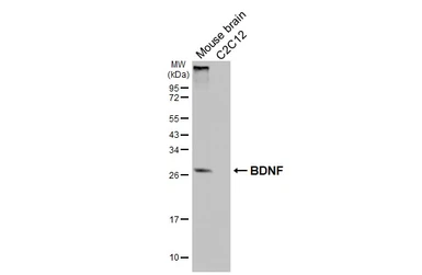 Anti-BDNF antibody [HL4205] used in Western Blot (WB). GTX643028