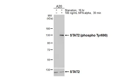 Anti-STAT2 (phospho Tyr690) antibody [HL4208] used in Western Blot (WB). GTX643031