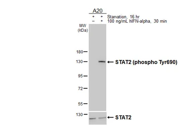 Anti-STAT2 (phospho Tyr690) antibody [HL4208] used in Western Blot (WB). GTX643031