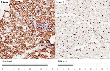 Anti-SLC25A1 antibody [HL4227] used in IHC (Paraffin sections) (IHC-P). GTX643060