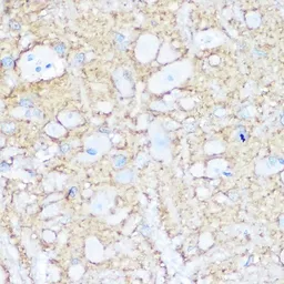 Anti-NCAM antibody used in IHC (Paraffin sections) (IHC-P). GTX64346