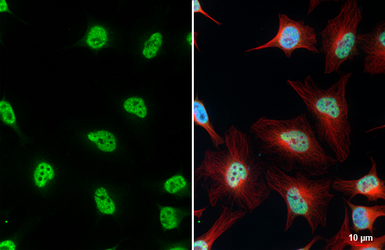 Anti-ALY antibody [HL4253] used in Immunocytochemistry/ Immunofluorescence (ICC/IF). GTX643489