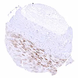 Anti-NPR-C antibody [HMV4274] HistoMAX&trade; used in IHC (Paraffin sections) (IHC-P). GTX643510