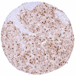 Anti-NPR-C antibody [HMV4274] HistoMAX&trade; used in IHC (Paraffin sections) (IHC-P). GTX643510