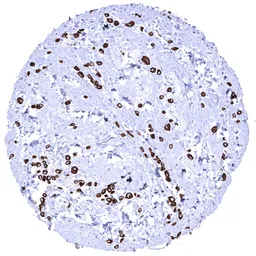Anti-pan Cytokeratin antibody [HMV4276] HistoMAX&trade; used in IHC (Paraffin sections) (IHC-P). GTX643512