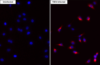 Anti-Tick-borne encephalitis virus (TBEV) prM protein antibody [HL4295] used in Immunocytochemistry/ Immunofluorescence (ICC/IF). GTX643535