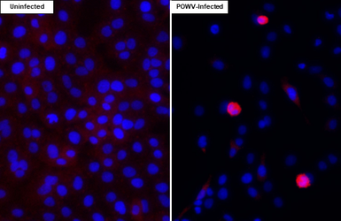 Anti-Powassan virus NS2B antibody [HL4296] used in Immunocytochemistry/ Immunofluorescence (ICC/IF). GTX643536