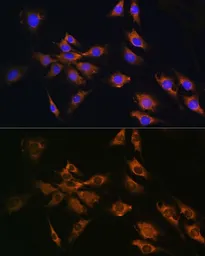 Anti-FGF2 antibody used in Immunocytochemistry/ Immunofluorescence (ICC/IF). GTX64354