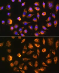 Anti-FGF2 antibody used in Immunocytochemistry/ Immunofluorescence (ICC/IF). GTX64354